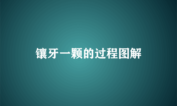 镶牙一颗的过程图解