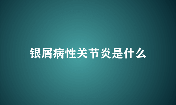 银屑病性关节炎是什么