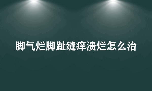 脚气烂脚趾缝痒溃烂怎么治