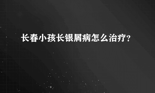 长春小孩长银屑病怎么治疗？