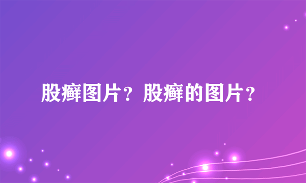 股癣图片？股癣的图片？