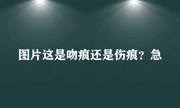 图片这是吻痕还是伤痕？急