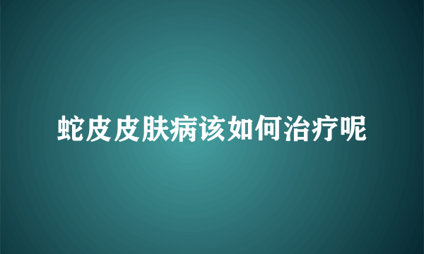 蛇皮皮肤病该如何治疗呢