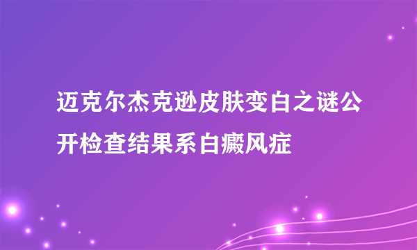 迈克尔杰克逊皮肤变白之谜公开检查结果系白癜风症