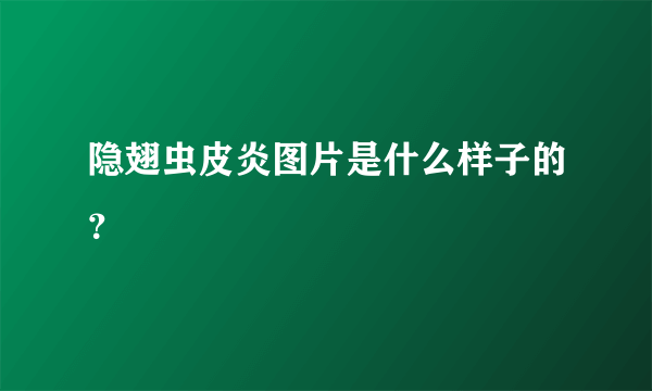 隐翅虫皮炎图片是什么样子的？